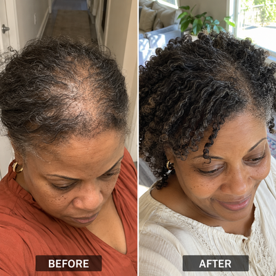 Pumpking Seed Oil Complex - Thinning Hair Formula