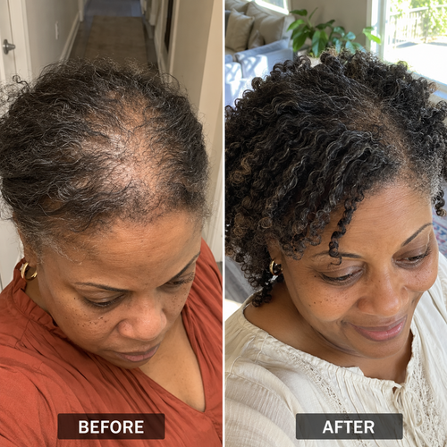 Pumpkin Seed Oil Complex - Thinning Hair Formula